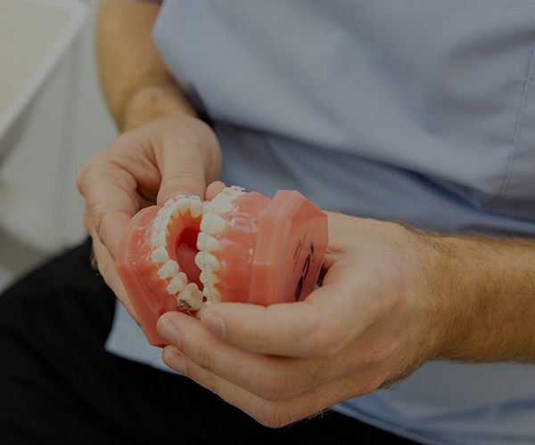 implant-post-1 Root Canal Treatments in Taunton, MA